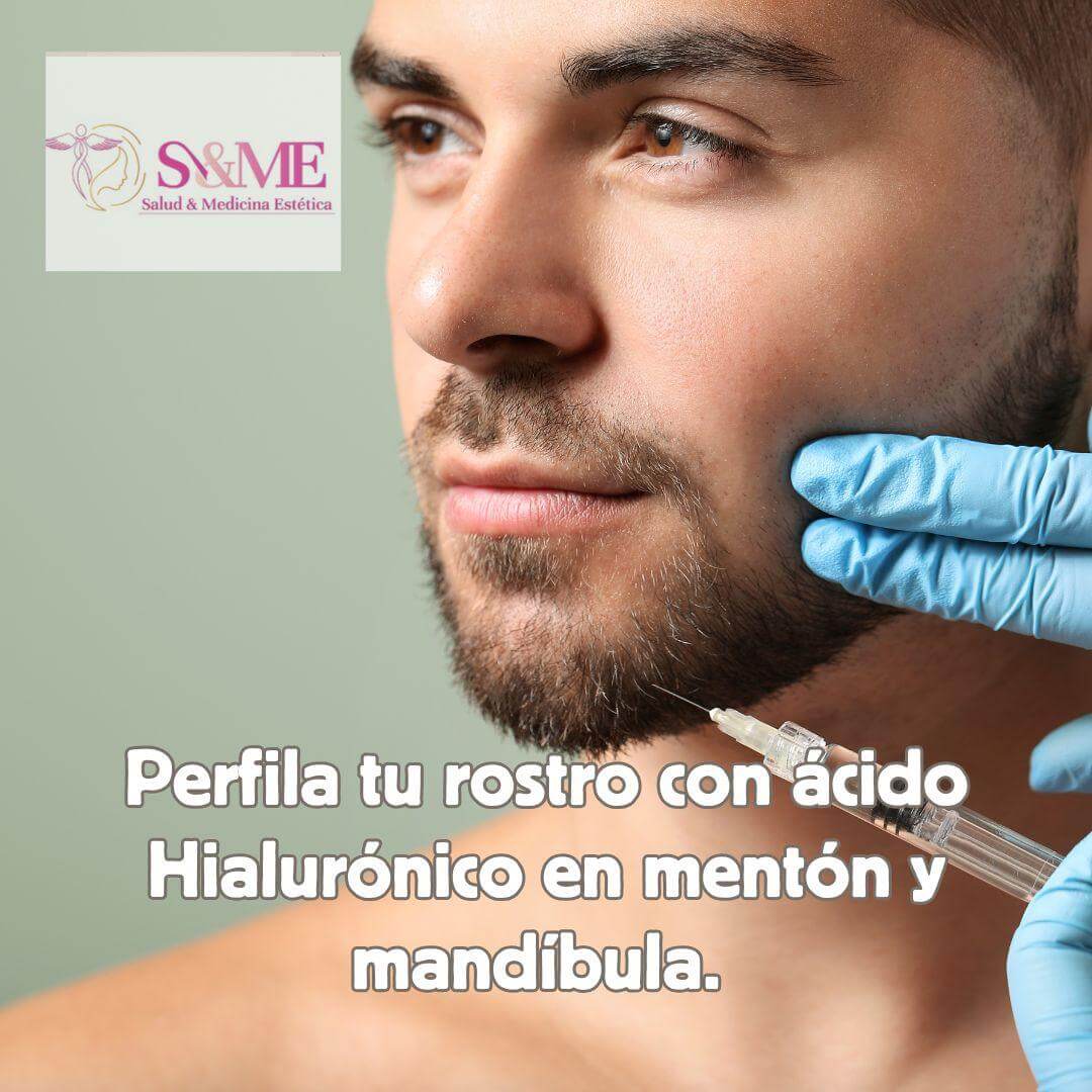 Toxina botulínica
